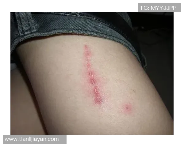 足球场上的咬人事件揭秘牙齿咬人的明星球员背后的故事