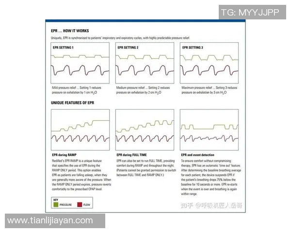 独家分析：深圳乒乓球队的技术对比
